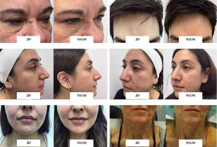 image025001 image025001